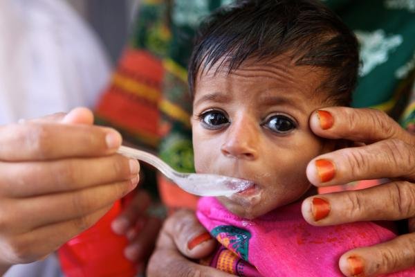 new-study-reveals-nutritional-status-of-under-five-in-india
