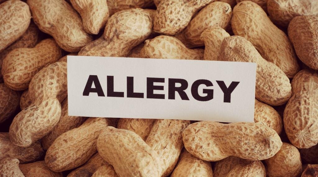 us-researchers-develop-skin-patch-for-peanut-allergy