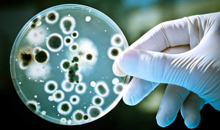 study-identifies-resistant-microbes-in-food-samples