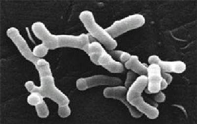 morinaga-milks-probiotic-bifidobacteriumlongum-bb536-achieves-self-affirmed-gras-for-infants
