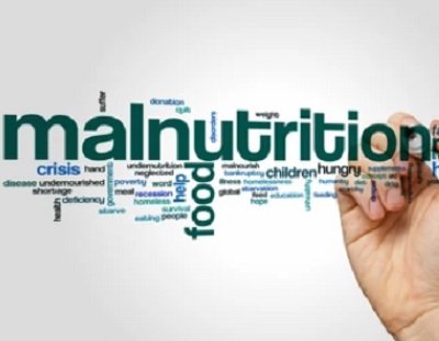 hadsa-svt-college-webinar-deliberates-on-severe-acute-malnutrition